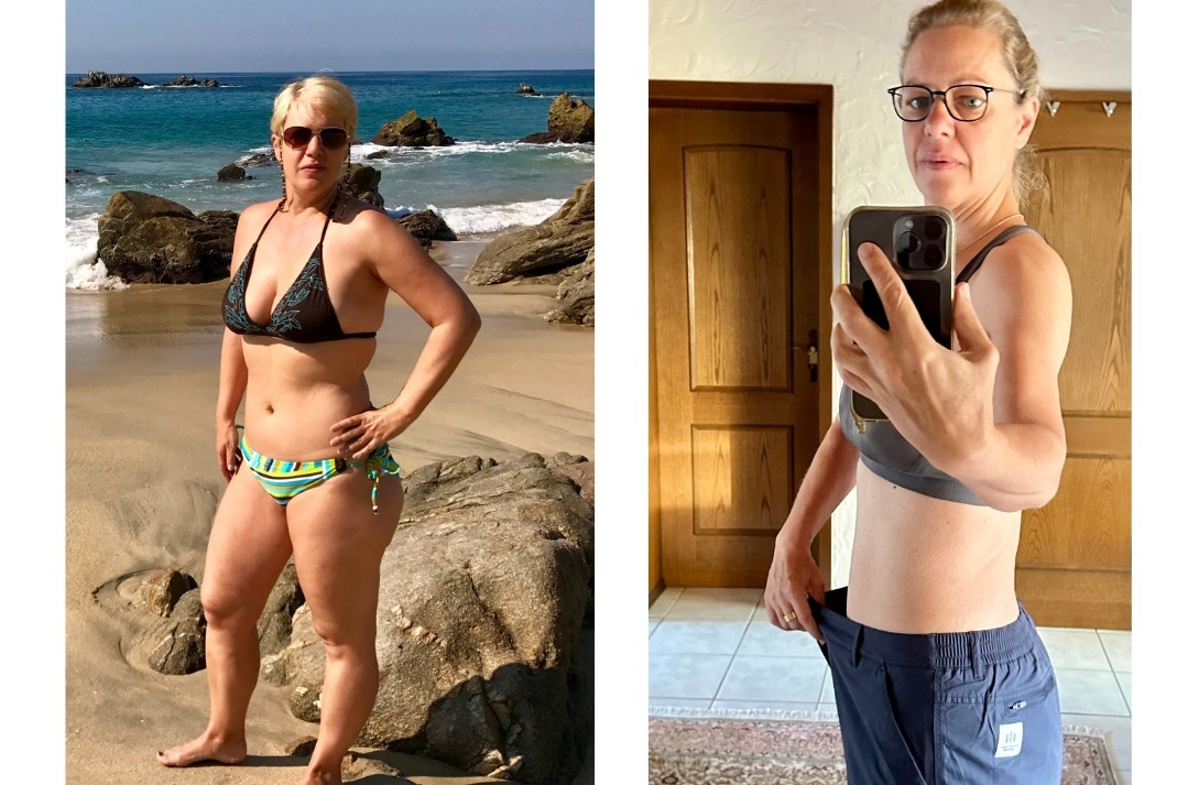 Vorher-Nachher-Foto einer Frau: links am Strand mit starkem Übergewicht, rechts nach erfolgreicher G